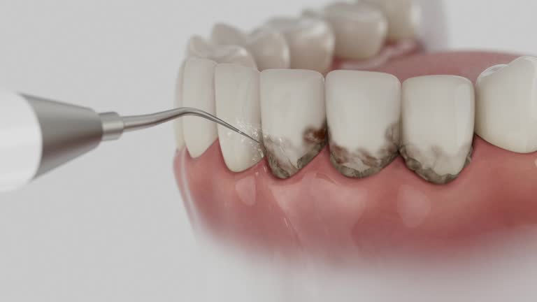 Reliable Dental contractor in Elwood, IN by Dentist Open Now